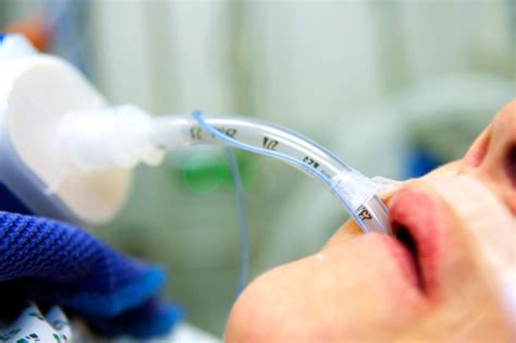 Most initially have an endotracheal tube; if they stay on the ventilator for many days or weeks, a tracheotomy may be done. . A nurse is caring for a client who is receiving mechanical ventilation via an endotracheal tube